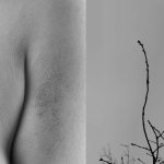 Arabella Rice - Black and white image of bruised, veiny skin next to twisting tree branches.